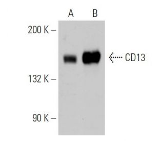 Western blot analysis of CD13 expression in GBB whole cell lysate (A) and GBB whole cell lysate immunoprecipitated with CD 