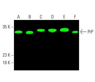 PrP Antibody (5B2) - Western Blotting - Image 378827 