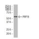 PRP19 Antibody (36-K) - Western Blotting - Image 34595 