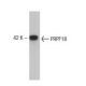PRPF18 Antibody (52) - Western Blotting - Image 133324 