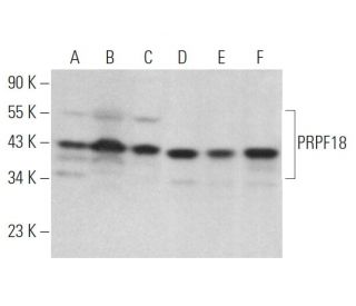 PRPF18 Antibody (52) - Western Blotting - Image 373218 