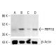 PRPF18 Antibody (52) - Western Blotting - Image 412905