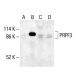 PRPF3 Antibody (B-1) - Western Blotting - Image 411991