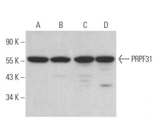 PRPF31 Antibody (A-6) - Western Blotting - Image 371497 