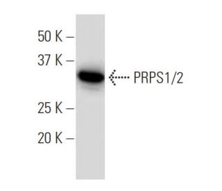 PRPS1/2 Antibody (EE-17) - Western Blotting - Image 34196