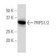 PRPS1/2 Antibody (EE-17) - Western Blotting - Image 34196