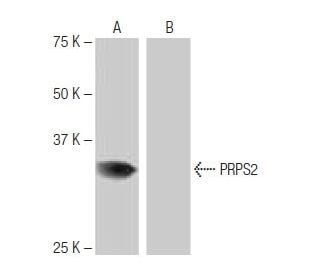 PRPS2 Antibody (4C11) - Western Blotting - Image 65041