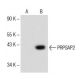 PRPSAP2 Antibody (A-1) - Western Blotting - Image 151724