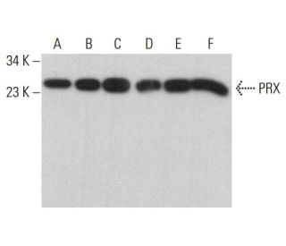 PRX Antibody (A-6) - Western Blotting - Image 380444 