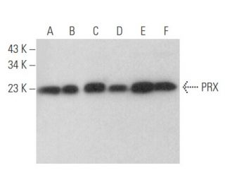 PRX Antibody (C-6) - Western Blotting - Image 354606 