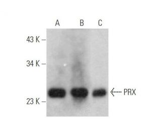 PRX Antibody (G-10) - Western Blotting - Image 352704 