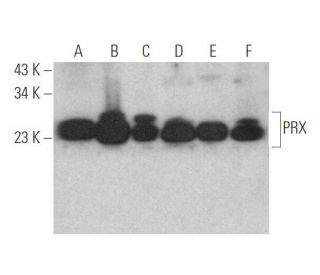 western blotting image from recommended PRX (B-11) monoclonal antibody replacement. Image 352472