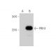 PRX II Antibody (H-4) - Western Blotting - Image 346450