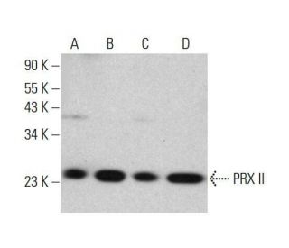 PRX II Antibody (H-4) - Western Blotting - Image 351862 