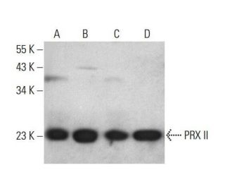 western blotting image from recommended PRX II (A-2) monoclonal antibody replacement. Image 351863