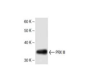 western blotting image from recommended PRX III (1) monoclonal antibody replacement. Image 136769