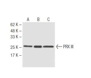 PRX III Antibody (4G10) - Western Blotting - Image 62844