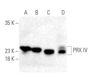 PRX IV Antibody (F-2) - Western Blotting - Image 398958 