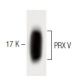 PRX V Antibody (44) - Western Blotting - Image 60422 