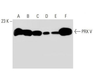 Anti Prx V Antibody H 5 Scbt Santa Cruz Biotechnology