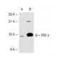 PRX V Antibody (H-5) - Western Blotting - Image 40017 