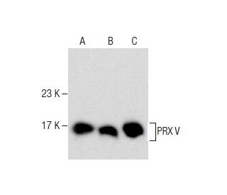 PRX V Antibody (8) - Western Blotting - Image 281220 
