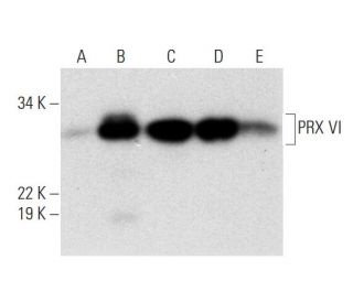 PRX VI Antibody (A-11) - Western Blotting - Image 291944 