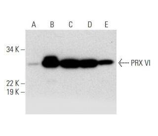 PRX VI Antibody (G-7) - Western Blotting - Image 291946 