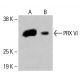 PRX VI Antibody (G-7) - Western Blotting - Image 415200