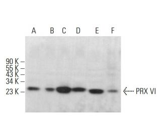 PRX VI Antibody (36) - Western Blotting - Image 382150