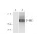 PRX1 Antibody (1E2) - Western Blotting - Image 347567 