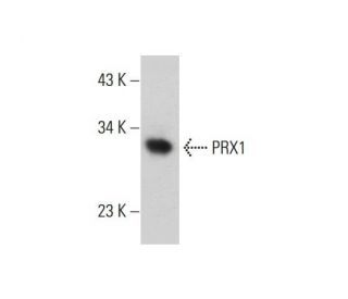 PRX1 Antibody (1E2) - Western Blotting - Image 384249 