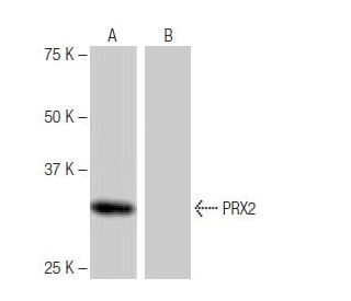 PRX2 Antibody (NQ-A42) - Western Blotting - Image 65042
