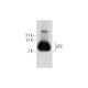 This polyclonal antibody has been discontinued. See our recommended <a href="ps2-antibody-a-10">pS2 (A-10)</a> monoclonal antibody (sample data shown). western blotting image from recommended pS2 (A-10) monoclonal antibody replacement. Image 320841