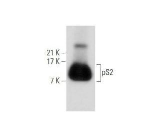 western blotting image from recommended pS2 (A-10) monoclonal antibody replacement. Image 320841