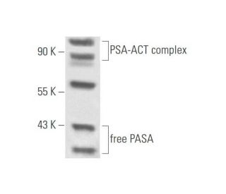 Prostate Specific Antigen/AACT Complex Antibody (4G10) - Western Blotting - Image 57853