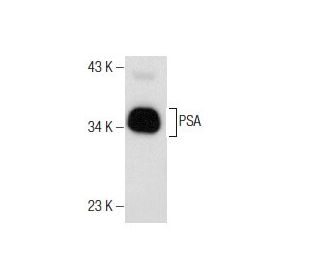 western blotting image from recommended PSA/KLK3/Kallikrein 3/Prostate Specific Antigen (A67-B/E3) monoclonal antibody replacement. Image 158432