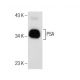 This polyclonal antibody has been discontinued. See our recommended <a href="psa-antibody-a67-b-e3">PSA/KLK3/Kallikrein 3/Prostate Specific Antigen (A67-B/E3)</a> monoclonal antibody (sample data shown). western blotting image from recommended PSA/KLK3/Kallikrein 3/Prostate Specific Antigen (A67-B/E3) monoclonal antibody replacement. Image 158432