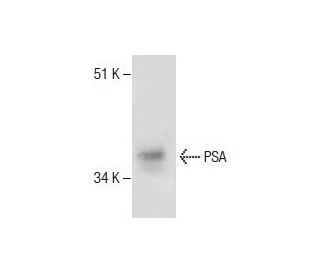 PSA/KLK3/Kallikrein 3/Prostate Specific Antigen Antibody (LT3D2) - Western Blotting - Image 286789