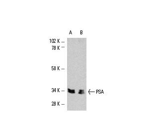 PSA/KLK3/Kallikrein 3/Prostate Specific Antigen Antibody (A67-B/E3) - Western Blotting - Image 3238