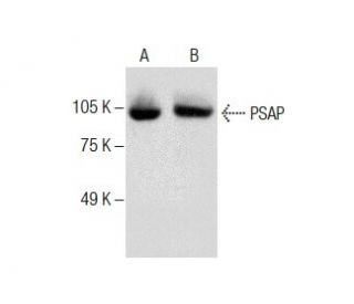 PSAP Antibody (E-5) - Western Blotting - Image 287217 