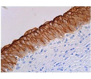 PSCA Antibody (7F5) - Immunohistochemistry - Image 365280 