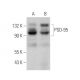 PSD-95 Antibody (2Q129) - Western Blotting - Image 377308