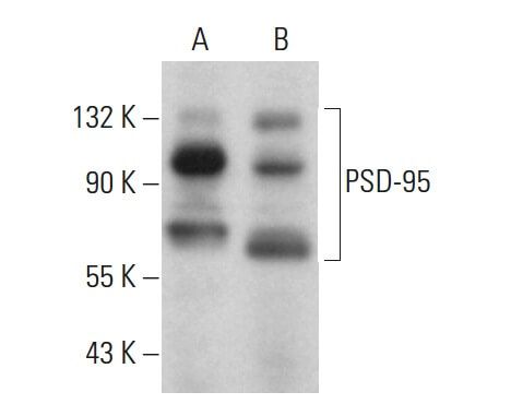 embryo スキントップス Axonal defects in zebrafish embryos treated with NCI-65828