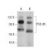 PSD-95 Antibody (4E181) - Western Blotting - Image 377224