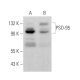 PSD-95 Antibody (6D677) - Western Blotting - Image 377309