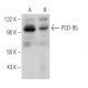 PSD-95 Antibody (6D678) - Western Blotting - Image 377306