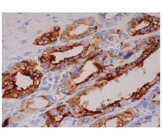 PSGL-1 Antibody (HECA-452) - Immunohistochemistry - Image 284753 