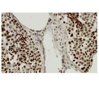 PSIP1 Antibody (3F7) - Immunohistochemistry - Image 36285