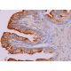 immunohistochemistry image from recommended PSM (F-2) monoclonal antibody replacement. Image 388707